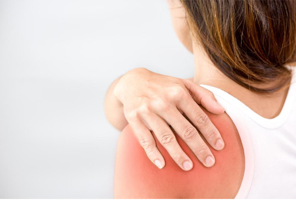 Frozen Shoulder