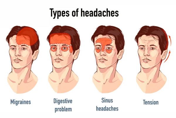 Headache