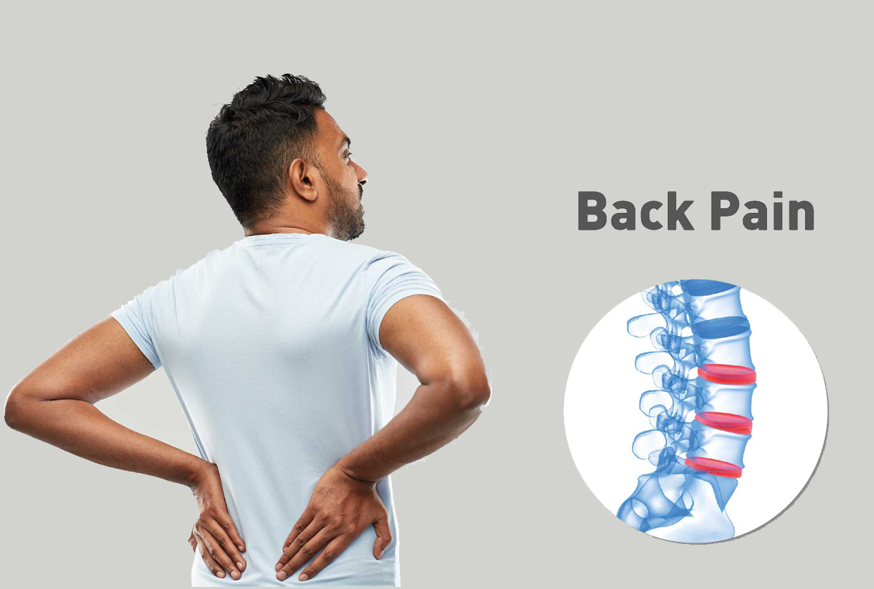 Back Pain