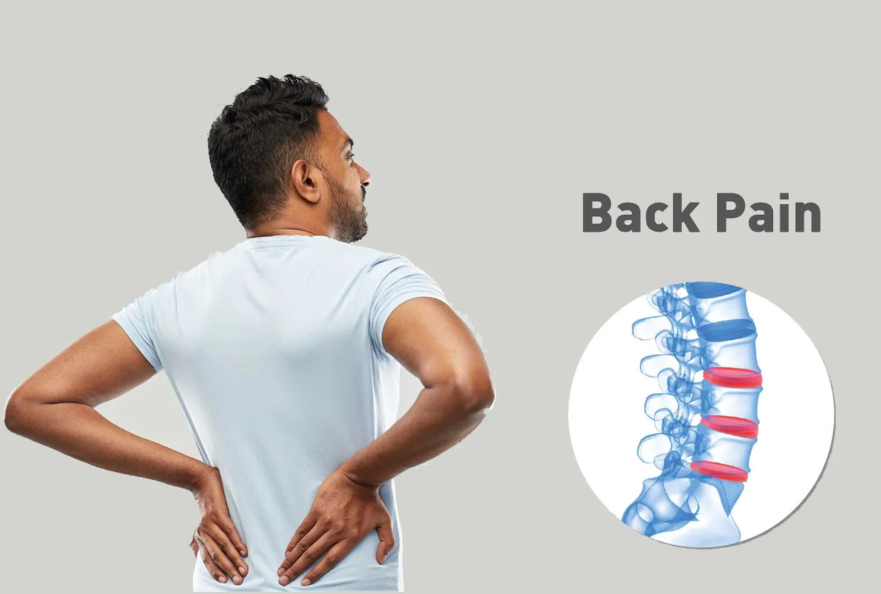 Back Pain